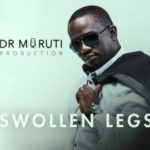 Dr Moruti – Swollen Legs