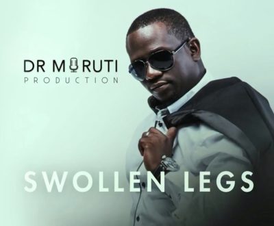 Dr Moruti – Swollen Legs